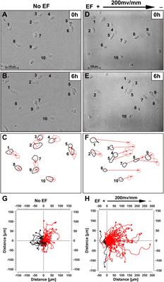 Migration of Human Renal Tubular Epithelial Cells in Response to Physiological Electric Signals